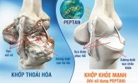 Xương chắc khỏe