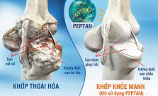 Xương chắc khỏe