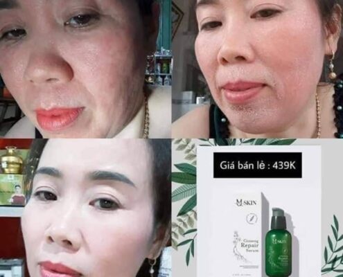 TRONG KHI SỬ DỤNG SERUM THAY DA NHÂN SÂM MQSKIN DA SẼ CÓ NHỮNG BIỂU HI
