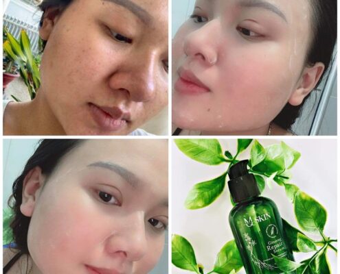 [HOT] Biểu hiện khi dùng serum thay da nhân sâm MQ Skin – Có sưng, đỏ, sạm, bong da không?