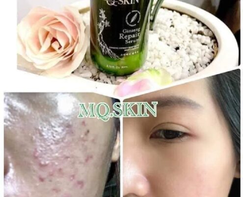 Phản Hồi Serum Thay Da Nhân Sâm Mqskin. Bạn nên xem trước khi mua!!