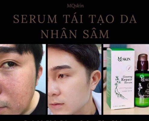 Lấy Sỉ Serum Thay Da Nhân Sâm MQskin ở đâu giá rẻ nhất? Bạn nên biết!