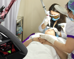 Laser – Giải pháp vàng cho tình trạng tăng sắc tố da vùng mặt