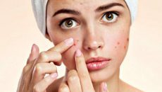 Hạn chế sử dụng sữa rửa mặt có chứa năm thành phần này- Beauty Buffet