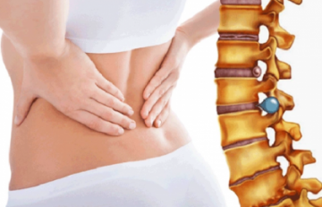 Phẫu thuật lấy nhân đệm chữa thoát vị đĩa đệm những điều cần biết