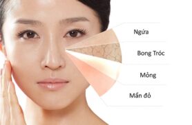7 cách trị dị ứng da mặt siêu đơn giản và hiệu quả nhất tại nhà