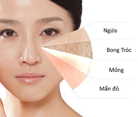 7 cách trị dị ứng da mặt siêu đơn giản và hiệu quả nhất tại nhà