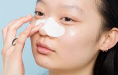“Lỗ chân lông là gì? Nguyên nhân và cách điều trị lỗ chân lông to?
