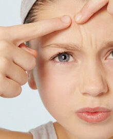Mụn ẩn là gì? Cách trị mụn ẩn tại nhà vừa an toàn vừa hiệu quả