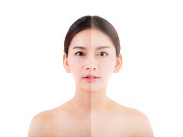 AHA, BHA VÀ TRETINOIN – LỰA CHỌN NÀO CHO LÀN DA HOÀN HẢO?