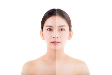 AHA, BHA VÀ TRETINOIN – LỰA CHỌN NÀO CHO LÀN DA HOÀN HẢO?