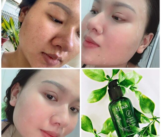 [HOT] Biểu hiện khi dùng serum thay da nhân sâm MQ Skin – Có sưng, đỏ, sạm, bong da không?