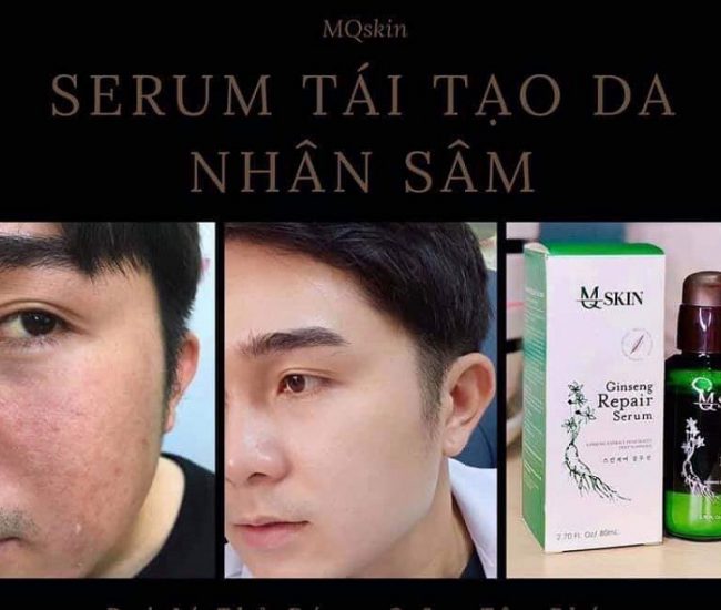 Lấy Sỉ Serum Thay Da Nhân Sâm MQskin ở đâu giá rẻ nhất? Bạn nên biết!