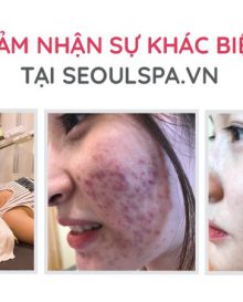 Trị Mụn Y Khoa