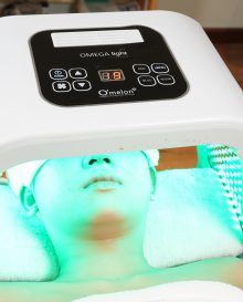 Điều trị da mụn