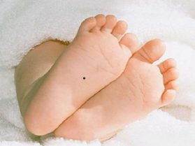 Xem bói nốt ruồi ở chân người giàu sang, có mệnh phú quý