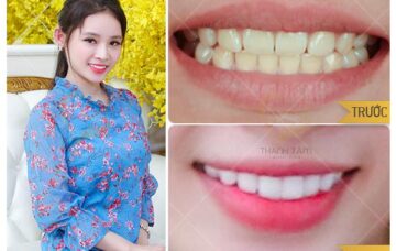 Mẫu 3