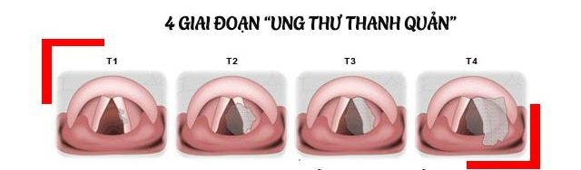 Các gói kiểm tra sức khỏe định kỳ